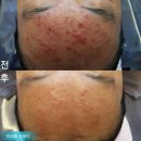 피부에설레다 이미지