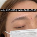 비로우