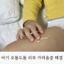 환절기 아기 피부 오톨도톨 가려움증 보습하는 방법