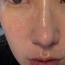 깐달걀스킨케어 | 깐달걀키트 7일 사용후기 화잘먹 피부 만들고 싶다면 메디테라피 깐달걀키트