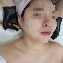 천안 피부샵 나스탈뷰티 피부재생관리 솔직 후기