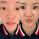 허브캐슬 | 정관 피부관리 올가드림뷰티 정관롯데캐슬점 모공 디톡스 후기