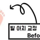 초이스핏 이미지