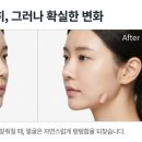 엘 스킨케어