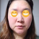 한설에스테틱 | 마스크팩추천 채윤614 환해진피부