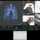 코어소프트 이미지