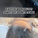 모스칼프 이미지