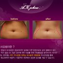 메디존스 이미지