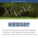 로운안과의원