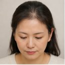 번헤어 바이(by) 증모가발 토탈샵 | 부산가발 40대 여성 헤어라인 탈모, 부분가발로 자연스럽게 해결한 후기