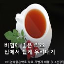 약초약국 | 비염 증상 완화에 효과적인 약초 차 5가지, 직접 마셔본 후기