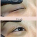 광원장 네이버블로그