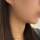 오오치과병원 | 노원역 침샘보톡스 피부과 내돈내산 리얼후기