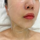 원흥피부관리 제이로운 스킨부스터 후기