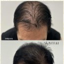 스테이 무 이미지