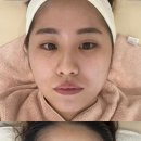믈리에스킨 이미지