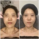 가온요양병원 | 방문 후기 : 동래피부관리 가온뷰티&amp;바디센터 윤곽관리 후기🧴 / 동래에스테틱, 명륜에스테틱 추천