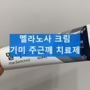 유스약국 | 멜라노사 크림 사용법과 부작용 기미 주근깨 효과 사용후기