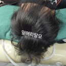 김호증모가발·소호헤어