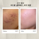 아이비에스테틱 이미지