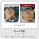 각시머리방 이미지