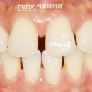 이사이치과의원 네이버블로그