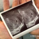 맘스밀리산후조리원강서 이미지