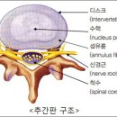 더문짐