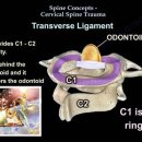 경추 외상(Cervical Spine Trauma) 왜 정확한 이해가 중요한가? 이미지