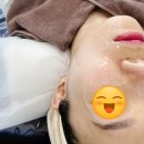 늘그린스킨 | 수원 웨딩케어 늘그린스킨, 이중턱 삭제! 일주일 뒤가 더 기대되는 끌올팅 리얼후기