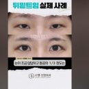 로웰성형외과의원 이미지