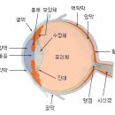 실명, 남의 이야기가 아니다! 망막박리란? (스마트폰 많이하는 여시, 아토피 여시 커몽커몽, 긴 글 주의) 이미지