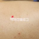 화접몽한의원 이미지