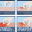 피부가려움증 왜 나타나는지 궁금하다면 이미지