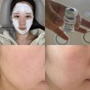 전세정독일피부과의원 | 홍대 피부과에서 쥬베룩 스킨부스터 맞고 온 후기 효과 시기 가격