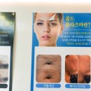 브로우제이 이미지