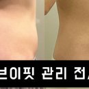 엠브이핏 이미지