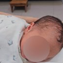 둘째 출산후기 | 제왕절개 수술 3일차 / 첫 수유콜 / 머리감기 언제부터 가능할까