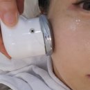 구미피부관리 트러블 홍조 다 잡아준 리쥬란부스터 에이원뷰티