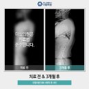 더힘의원 네이버블로그