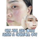 부산 덕천 피부과 잡티제거 / 덕천동 클라리티레이저 딱지 &amp; 리쥬란 내돈내산 후기