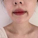 로즈 인셀덤 - 송파구 | 인셀덤 버터 립틴트 4호 이브링로즈 발색후기