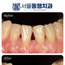 동행치과의원 네이버블로그