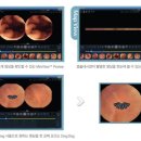 인트로메딕↑…"스마트 내시경 개발 프로젝트 출범"@@ 이미지