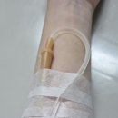 엔탑 | 메니에르병 진단받고 엔탑이비인후과 1인실 10일 입원후기 (귀먹먹, 이명, 난청, 어지러움, 어지럼증...