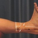 Ankle Taping 이미지