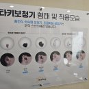 스타키보청기화정센터 이미지