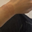 김혜영피부과