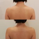 보네르땅 | 양산피부관리 보네르에스테틱 솔직후기(등 관리, 목신경테라피, LDM 관리)
