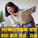 허리 삐끗했을 때 병원, 증상, 자세 이미지